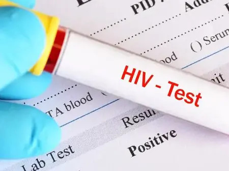 New HIV Data Alarms Health Experts: Women Most Affected in 2025