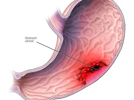 4 Powerful Fruits That Naturally Improve Blood Circulation In Your Body